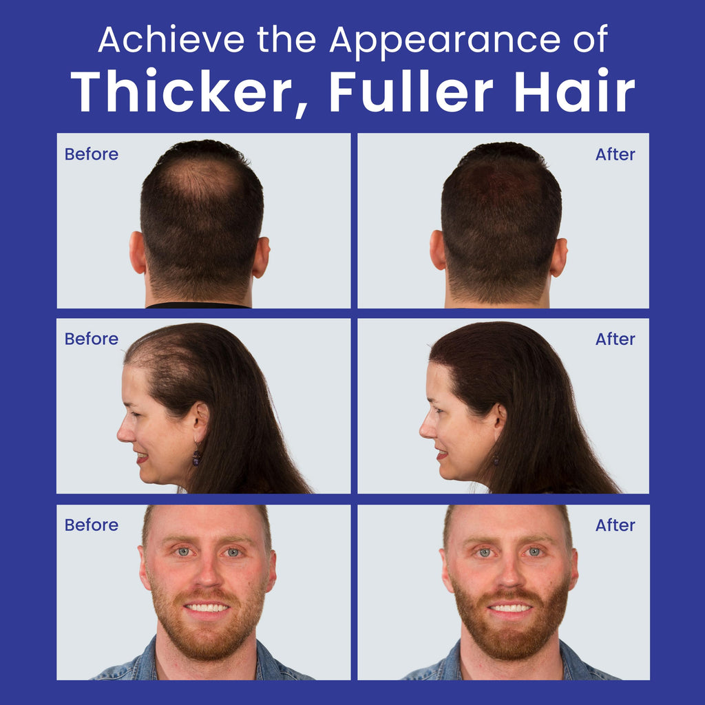 White Hair Fiber Powder 30g I834