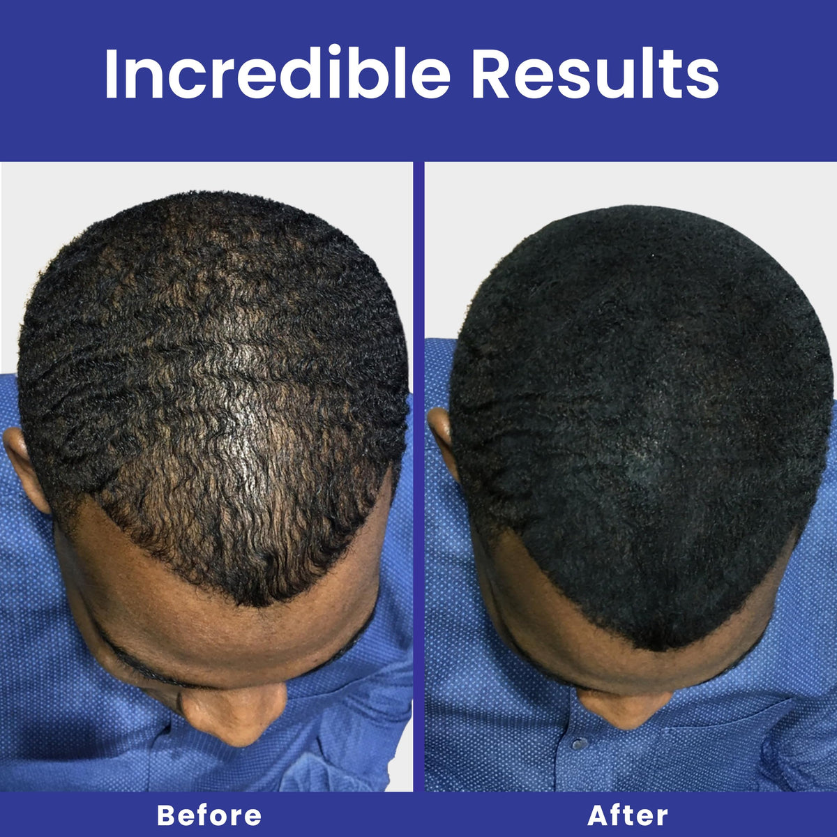 White Hair Fiber Powder 30g I834